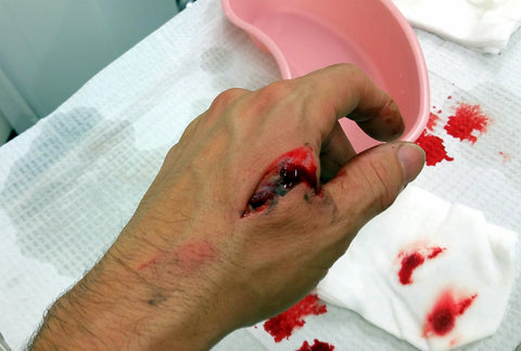 laceration before stitches