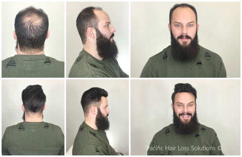 male pompadour hair piece before and after