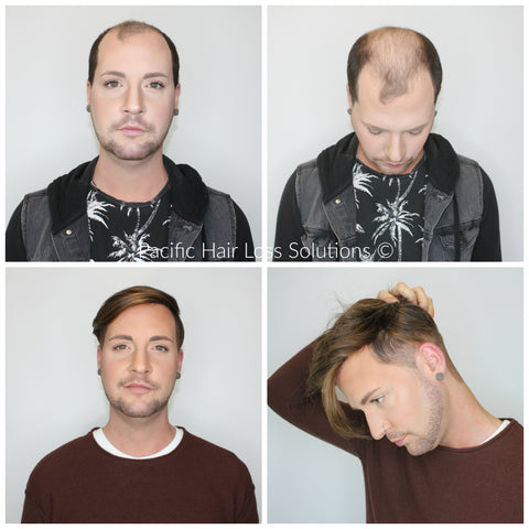 Men's before after long hair piece system installation at Pacific Hair Vancouver
