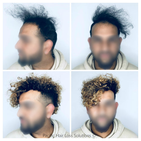 before and after of curly hairpiece (Odell Beckham Jr style) pacific hair
