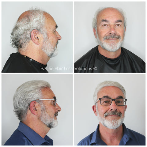 Men's white grey hair piece system installation at Pacific Hair Vancouver