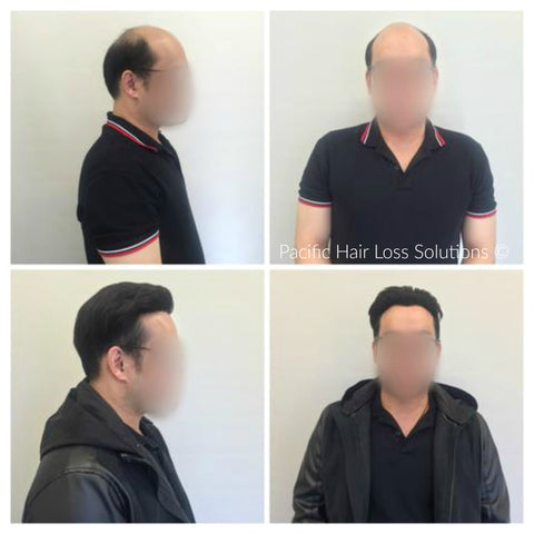 men's slicked back under cut with hair piece Vancouver