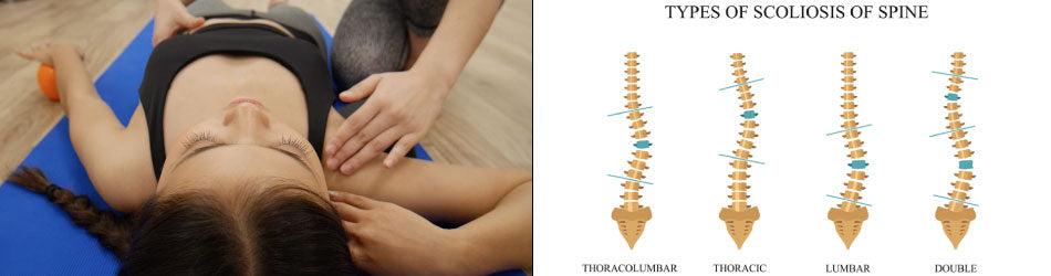 Scoliosis Treatment Bangkok รักษากระดูกสันหลังคด