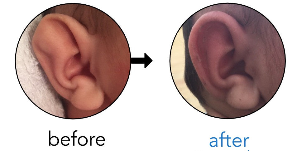 Arreglar una oreja de stahl