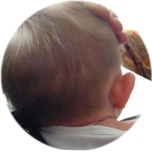 before earbuddies | baby head seen from behind at 7 weeks old