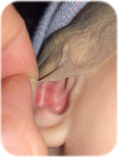 Capillary Injection in a Baby's Ear