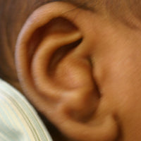 Conchal crus in a baby's ear