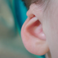 Photo of a Baby's Ear who has Cryptotia