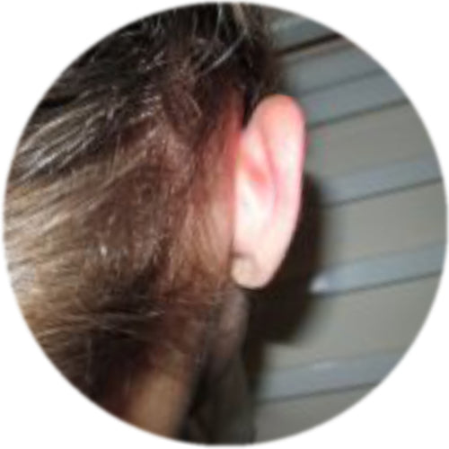 circular picture of a child's ear from the back