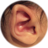 folded over helical rim deformity before using ear buddies