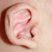 edge of babies ear folded over