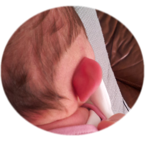 newborn baby ear with no folds as seen from the back
