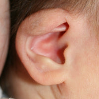 The upper part of baby's ear folded over
