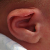 The top of the baby's ear folds over