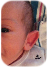 newborn baby developing a pointed elf ear