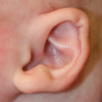 picture of a baby's ear with a notch in it or a kink in the edge of the rim
