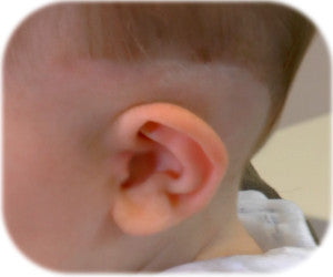 Shaving the hair above the Ear | ear buddies | correct stick out ears