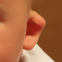 A Cup Ear is tight and inflexible, looks cup-shaped, and often also sticks out.