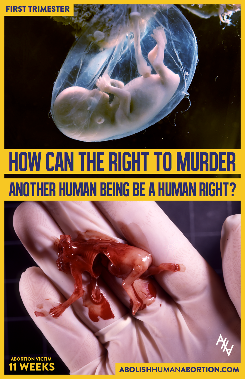 How Can The Right To Murder Sign