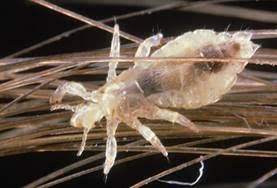 Head Lice