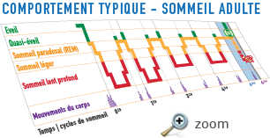 hypnogramme axbo réveil cycle sommeil