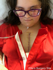 Ellie's open heart surgery scar in chief's red with nasal cannula for oxygen