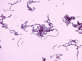 Image of Streptococcus virus