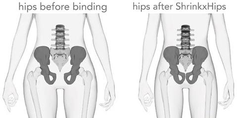 Understanding Postpartum Hip Changes And Hip Binding Upspring