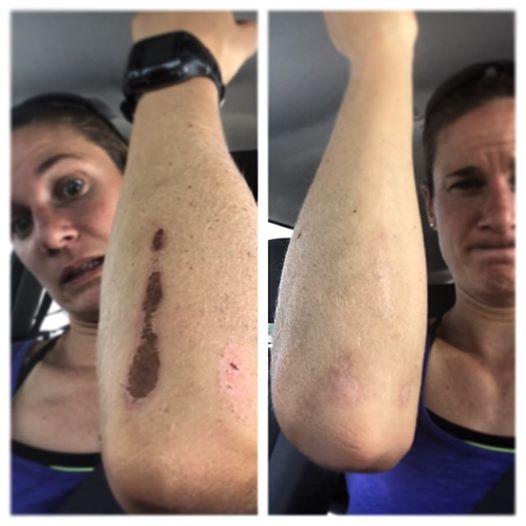 Katie Zaferes injury