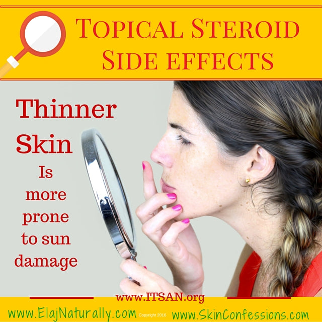 Topical Steroid Side Effects on Thinning Skin on Face