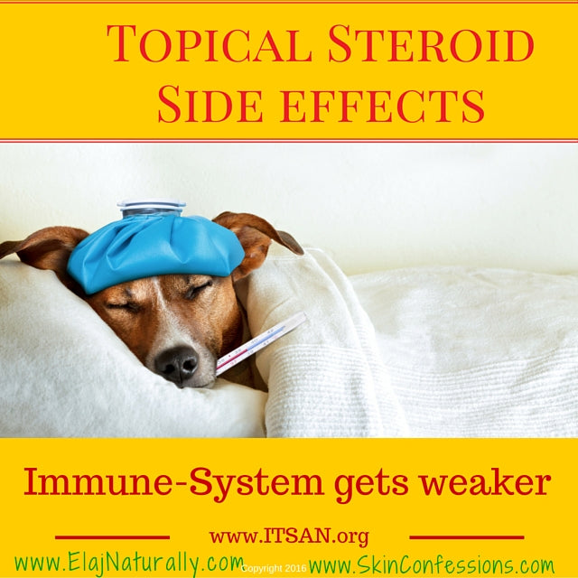 Topical Steroid Side Effects on Immune System