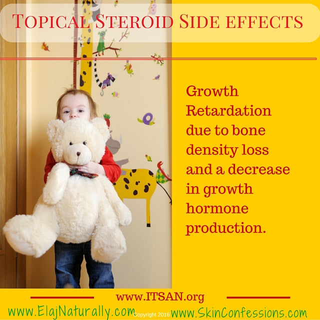 Topical Steroid Side Effects Growth Retardation
