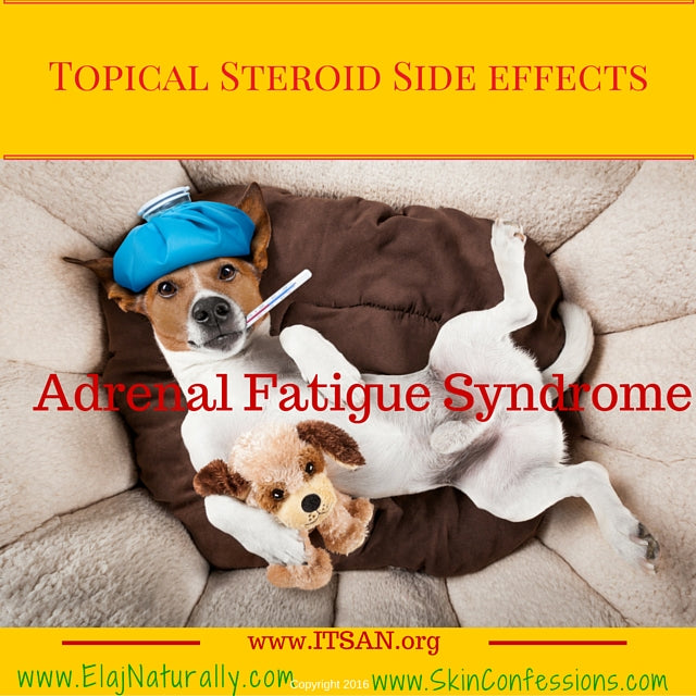 Topical Steroid Side Effects Adrenal Fatigue