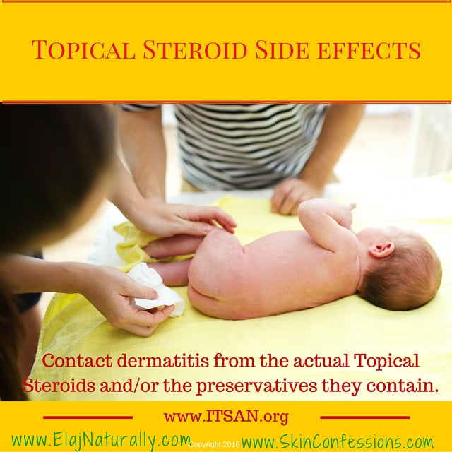 Topical Steroid Side Effects on Babies