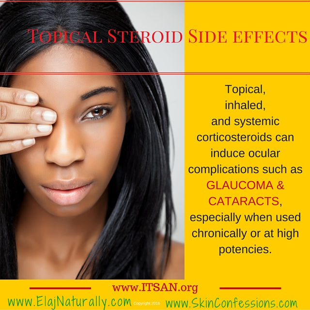 Topical Steroid Side Effects on Glaucoma and Cataracts