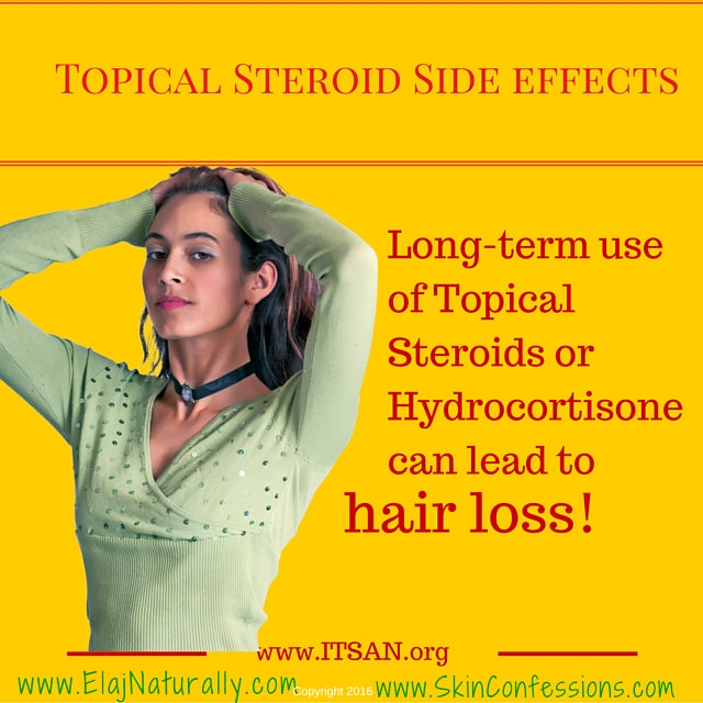 Topical Steroid Side Effects on Hair Loss