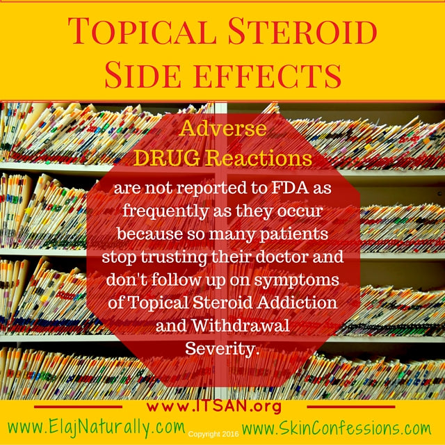 Topical Steroid Side Effects Adverse Drug Reactions