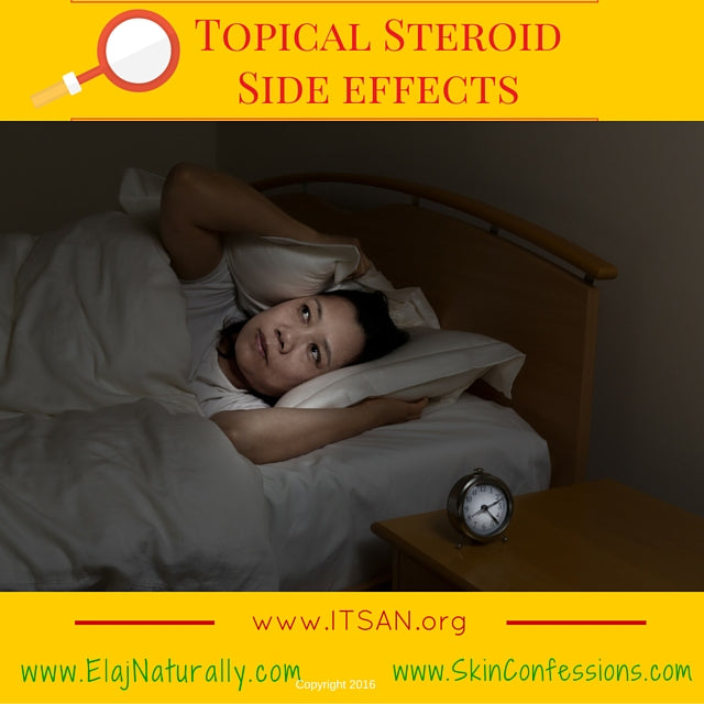 Topical Steroid Side Effects on Sleeping
