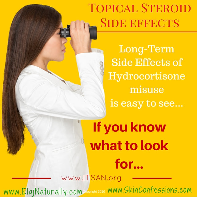 Topical Steroid Side Effects can be LONG TERM