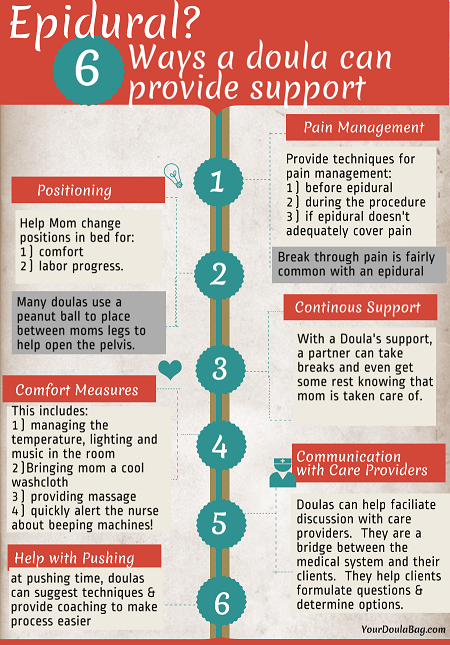 Epidural? 6 ways that a doula can support. 