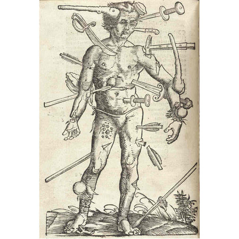 Renaissance wound man image 