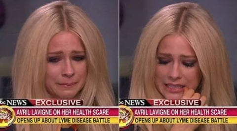 Avril Lavigne suffered from Lyme disease