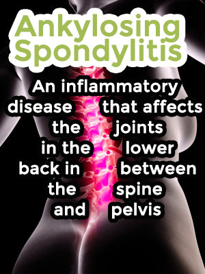 Ankylosing spondylitis in pregnancy 