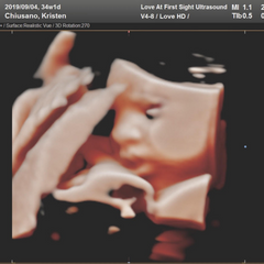 Sonogram