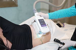 woman receiving coolsculpting treatment while relaxing on a examining table