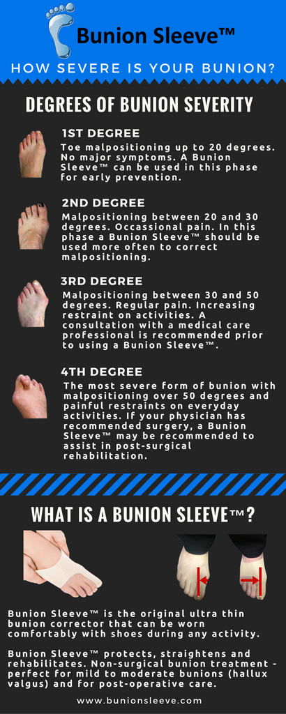 how-severe-is-your-bunion.png