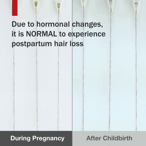 Due for hormonal changes, hair loss is normal