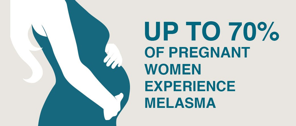 Pregnant women with melasma