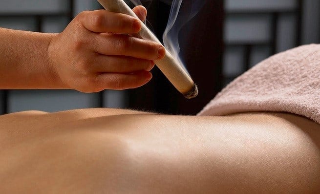 moxibustion