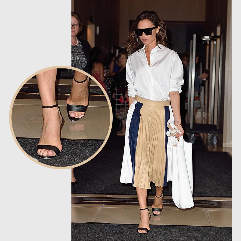 Former Spice Girl, Victoria Beckham has Bunion Removal Surgery